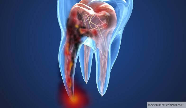 Abrechnung Endodontie – packen wir’s an der Wurzel!